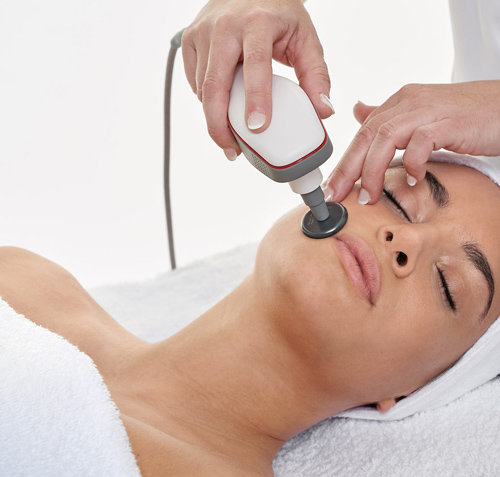 Radiofrecuencia Indiba rejuvenecimiento facial